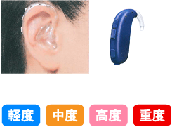 耳型タイプ1
